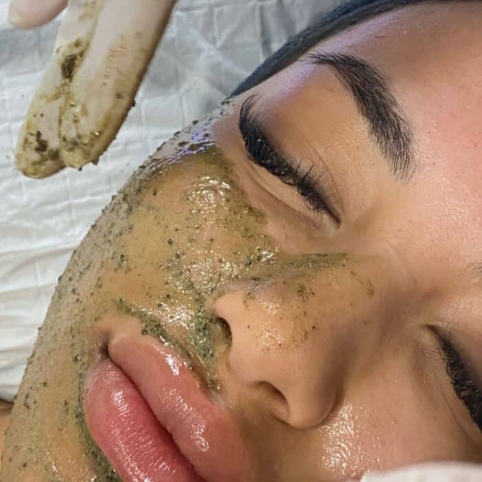 An in-treatment shot of a client having a chemical peel applied, part of a professional exfoliation process to renew the skin.