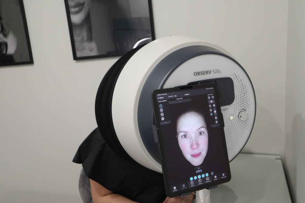Client undergoing a skin tightening treatment to improve firmness and elasticity at a cosmetic clinic.