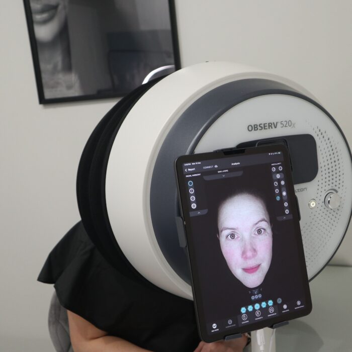Client undergoing a skin tightening treatment to improve firmness and elasticity at a cosmetic clinic.