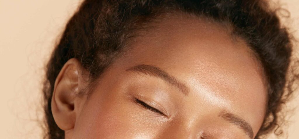 close up of cheek and forehead of a woman with dark hair and oily skin