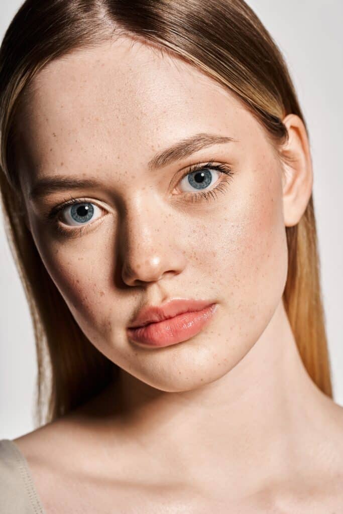 young woman prone to redness and rosacea on her face