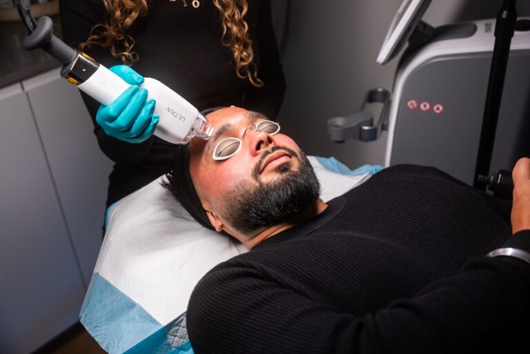 A LaseMD Laser Treatment in progress in Parramatta