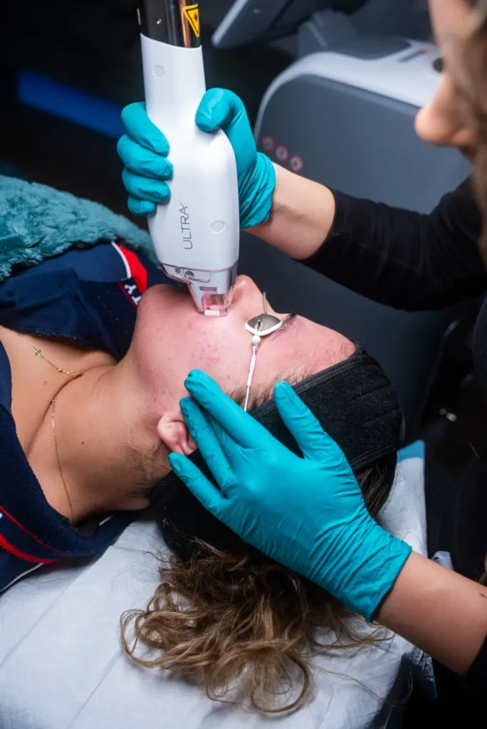 Facial LaseMD Treatment in progress