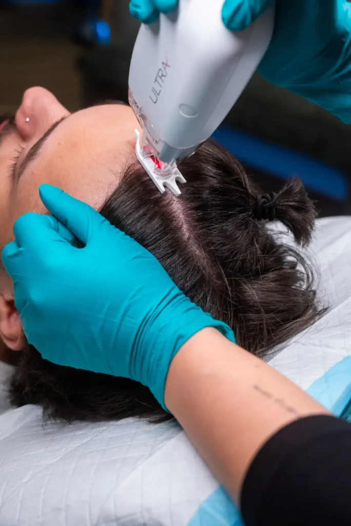 LaseMD Treatment handle for scalp repair